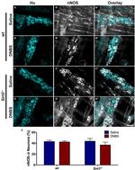 HuC/HuD Antibody in Immunohistochemistry (IHC)