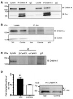 CaMKII beta Antibody in Immunoprecipitation (IP)