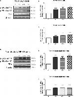 Phospho-Estrogen Receptor alpha (Ser167) Antibody in Western Blot (WB)