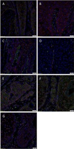 SOX2 Antibody in Immunohistochemistry (IHC)