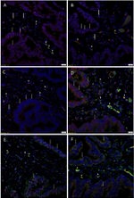 SOX2 Antibody in Immunohistochemistry (IHC)