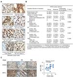 c-Myc Antibody in Immunohistochemistry (IHC)