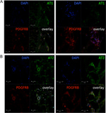 AGTR1 Antibody in Immunohistochemistry (IHC)