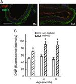 Dinitrophenyl-KLH Antibody in Immunohistochemistry (IHC)