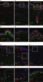 CD39 Antibody in Immunohistochemistry (IHC)