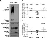 Cofilin Antibody in Western Blot (WB)