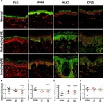 Cofilin Antibody in Immunohistochemistry (IHC)