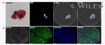 CD326 (EpCAM) Antibody in Immunocytochemistry (ICC/IF)