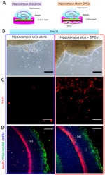 PSA-NCAM Antibody in Immunohistochemistry (IHC)