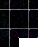 SOX2 Antibody in Immunohistochemistry (IHC)