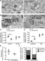 NMDAR2A Antibody in Immunomicroscopy (IM)