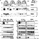 AIF Antibody in Western Blot, Immunoprecipitation (WB, IP)