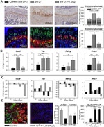 VDR Antibody in ChIP Assay (ChIP)