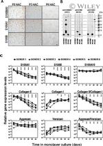 S100A1 Antibody in Western Blot, Immunocytochemistry (WB, ICC/IF)