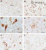 Leptin Receptor Antibody in Immunohistochemistry (IHC)