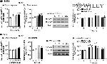 ALK Antibody in Western Blot (WB)