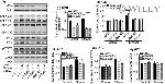 ALK Antibody in Western Blot (WB)