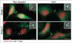 VTA1 Antibody in Immunocytochemistry (ICC/IF)