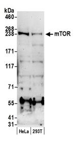 mTOR Antibody in Western Blot (WB)