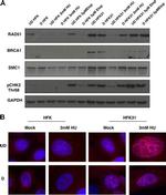 BRCA1 Antibody in Western Blot (WB)