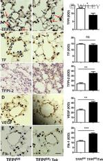 CD309 (FLK1) Antibody in Immunohistochemistry (Paraffin) (IHC (P))