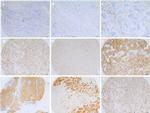 Claudin 7 Antibody in Immunohistochemistry (IHC)