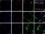 Amyloid Precursor Protein Antibody in Immunohistochemistry (Paraffin) (IHC (P))