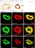 beta Amyloid Antibody in Immunohistochemistry (IHC)