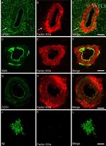 beta Amyloid Antibody in Immunohistochemistry (IHC)