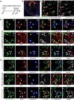 CD140b (PDGFRB) Antibody in Immunohistochemistry (IHC)