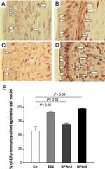 Estrogen Receptor beta Antibody in Immunohistochemistry (IHC)