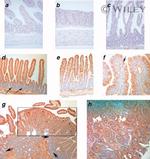 EphA2 Antibody in Immunohistochemistry (IHC)