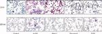 Tyrosinase Antibody in Immunohistochemistry (IHC)