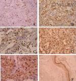 Aurora B Antibody in Immunohistochemistry (IHC)