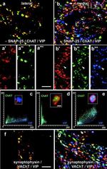 SNAP25 Antibody in Immunohistochemistry (IHC)