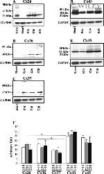 Connexin 26 Antibody in Western Blot (WB)