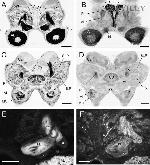 uNOS Antibody in Immunohistochemistry (IHC)