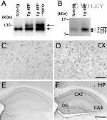 Amyloid Precursor Protein Antibody in Western Blot, Immunohistochemistry (WB, IHC)