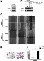 Metadherin Antibody in Western Blot (WB)