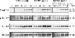 SMAD3 Antibody in Western Blot (WB)