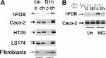 VDR Antibody in Western Blot (WB)