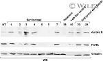 Aurora B Antibody in Western Blot (WB)