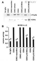 Phospho-Rb (Thr821) Antibody in Western Blot (WB)