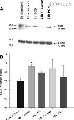 Connexin 26 Antibody in Western Blot (WB)