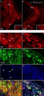 nNOS Antibody in Immunohistochemistry (IHC)