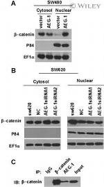 Metadherin Antibody in Immunoprecipitation (IP)