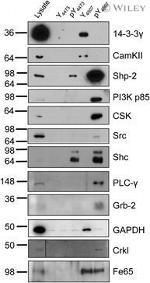 CaMKII beta Antibody in Western Blot (WB)