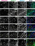 Opsin 4 Antibody in Immunocytochemistry (ICC/IF)