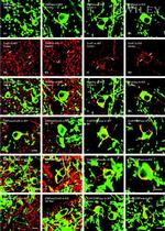 Connexin 47 Antibody in Immunohistochemistry (IHC)