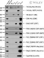 CaMKII beta Antibody in Western Blot (WB)